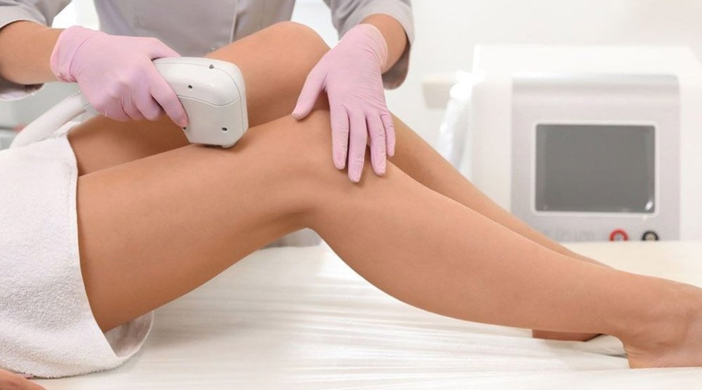 laser hair removal in chicago