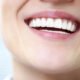 teeth need professional whitening treatment