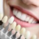 modern dental aesthetics