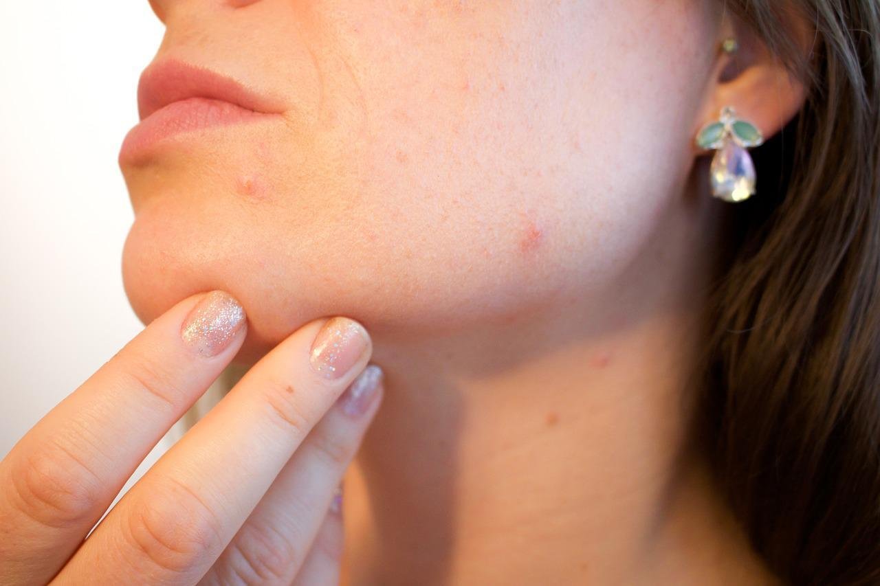 the science behind environ and the importance of vitamin a 4