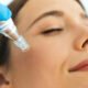 undergoing rf needling treatment
