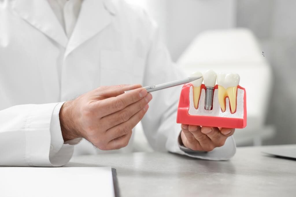 10 reasons to choose dental implants for tooth replacement