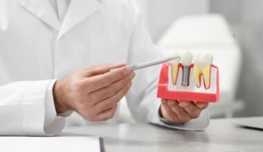 10 reasons to choose dental implants for tooth replacement