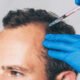 effective hair loss treatment