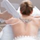 tattoo removal