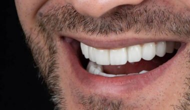 enhancing dental precision