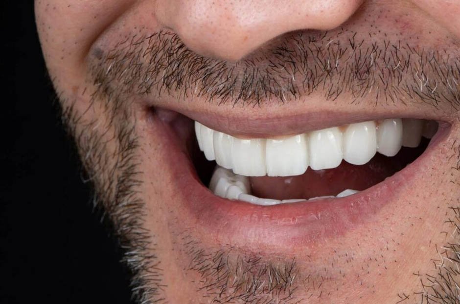 enhancing dental precision