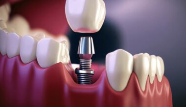 jawbone health influences your tooth replacement success