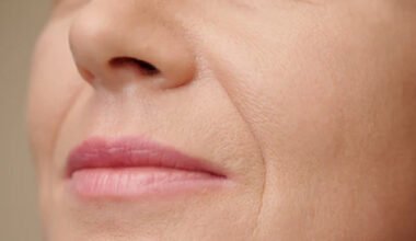 why cheeks and lips lose fullness over time