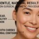 achieving natural looking results with non surgical cosmetic procedures