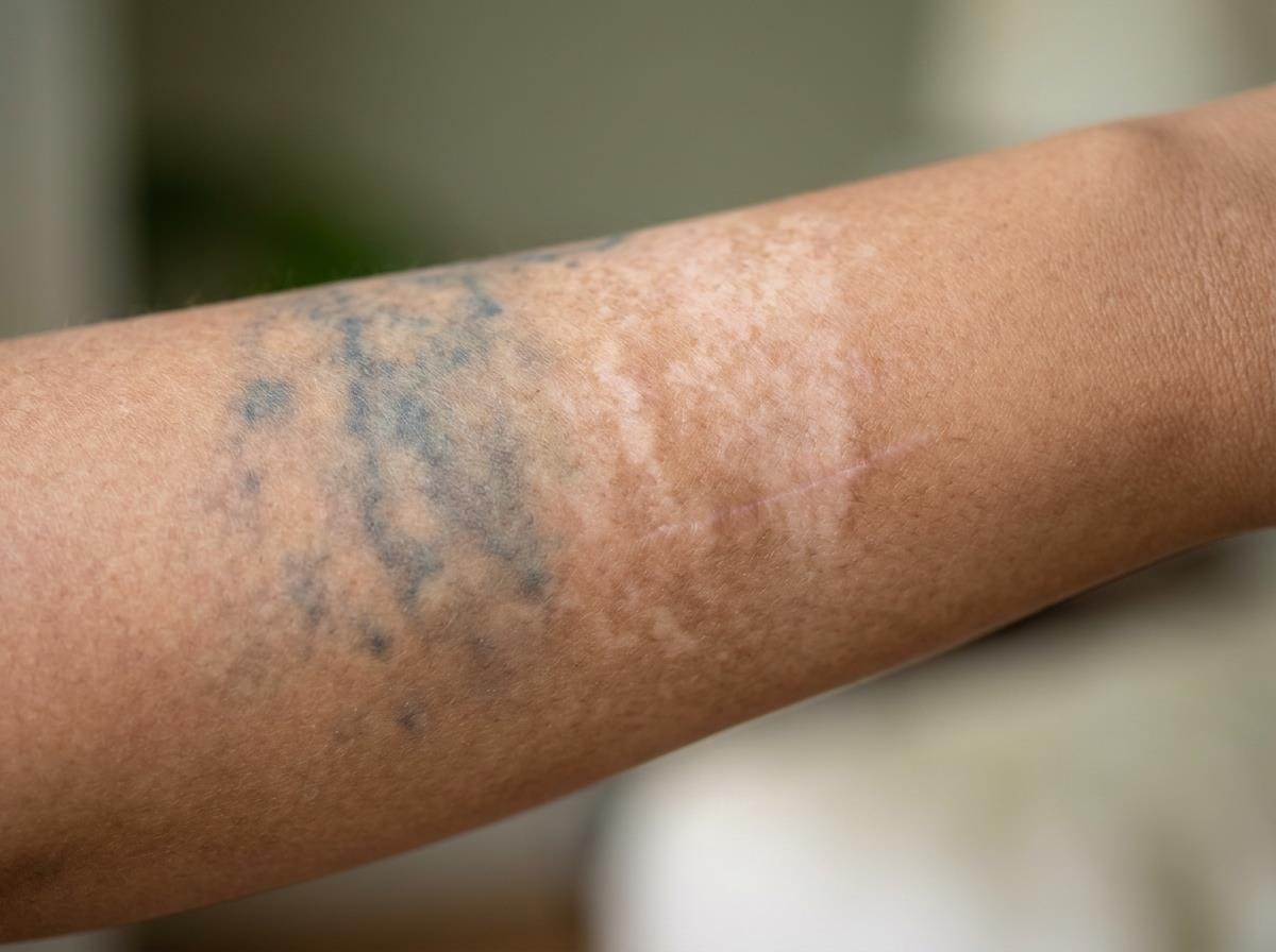 exploring the benefits of regenerative aesthetics 4